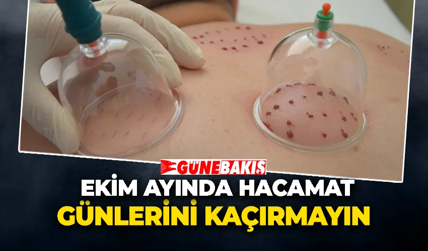 Ekim Ayında Hacamat Günlerini Kaçırmayın
