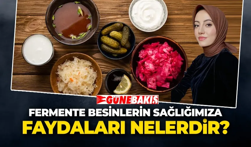 Fermente Besinlerin Sağlığımıza Faydaları Nelerdir? 