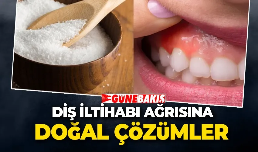 Diş İltihabı Ağrısına Doğal Çözümler: Hangi Bitkiler ve Çaylar Etkili?