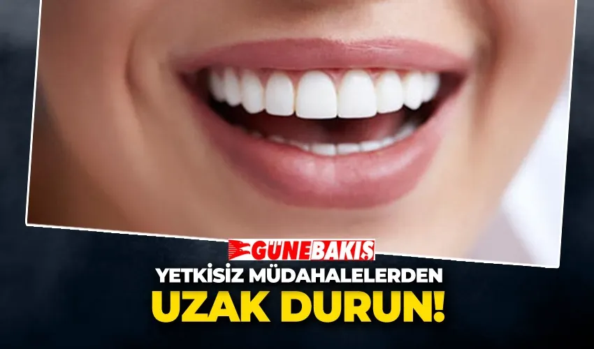 Doğal Dişi Koruyun, Yetkisiz Müdahalelerden Uzak Durun! 