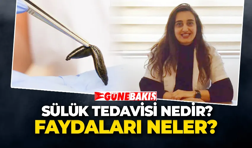 Sülük Tedavisi Nedir? Faydaları neler?