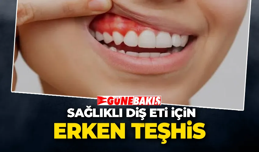 Sağlıklı Diş Eti İçin Erken Teşhis 