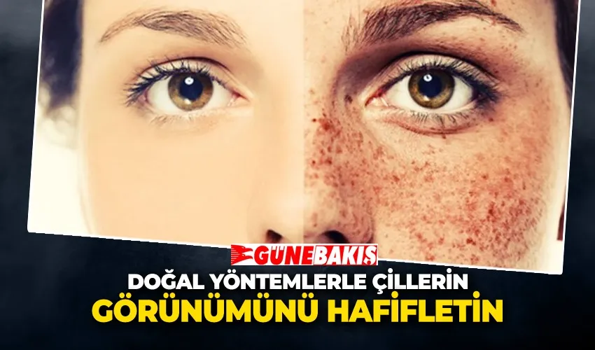 Doğal Yöntemlerle Çillerin Görünümünü Hafifletin