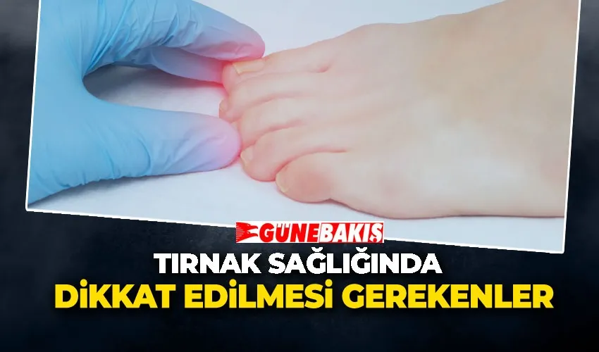TIRNAK SAĞLIĞINDA DİKKAT EDİLMESİ GEREKENLER