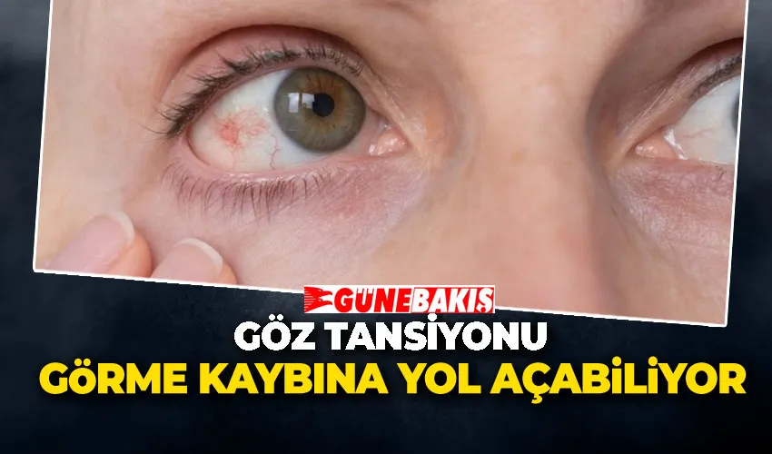 Göz Tansiyonu Sessizce Görme Kaybına Yol Açabiliyor