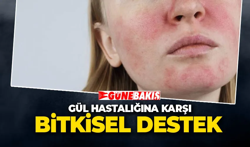 Gül Hastalığına Karşı Bitkisel Destek