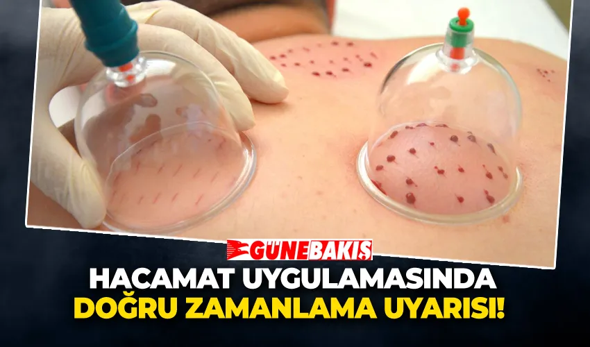 Hacamat Uygulamasında Doğru Zamanlama Uyarısı