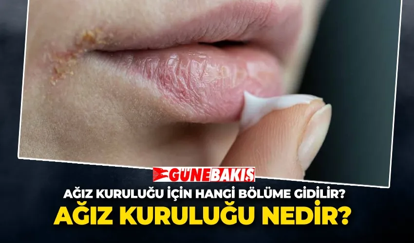 Ağız Kuruluğu Nedir? Ağız Kuruluğu İçin Hangi Bölüme Gidilir?