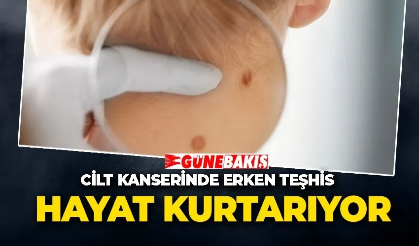 Cilt Kanserinde Erken Teşhis Hayat Kurtarıyor