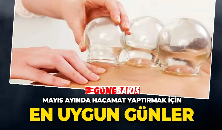 Mayıs Ayında Hacamat Yaptırmak İçin En Uygun Günler