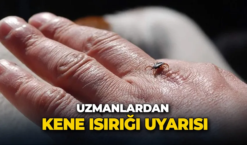 Uzmanlar; 