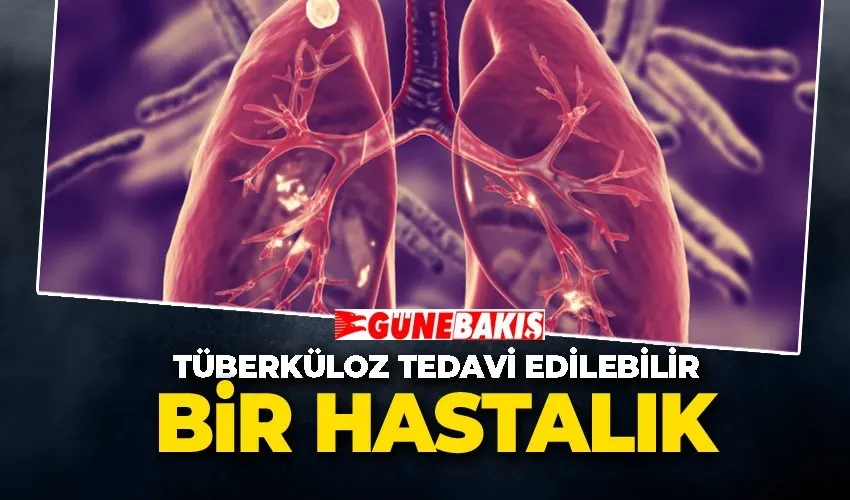 Tüberküloz Tedavi Edilebilir Bir Hastalık! Tedaviyi İhmal Etme!