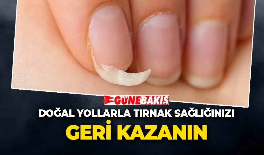 Doğal Yollarla Tırnak Sağlığınızı Geri Kazanın