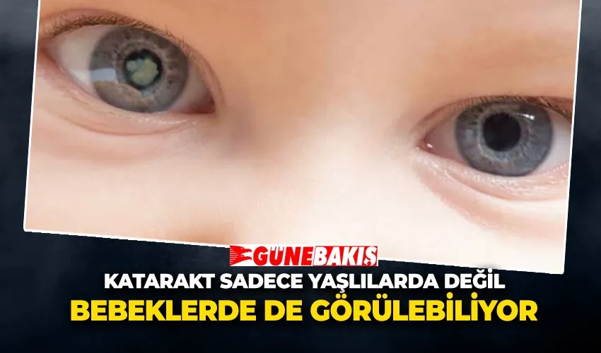 Katarakt Sadece Yaşlılarda Değil Bebeklerde de Görülebiliyor