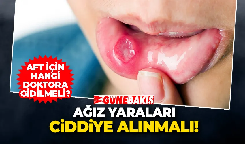 Ağız Yaraları Ciddiye Alınmalı: Aft İçin Hangi Doktora Gidilmeli?