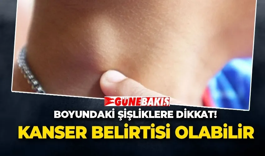 Boyundaki Şişliklere Dikkat! Boyundaki Şişliklere Dikkat! 