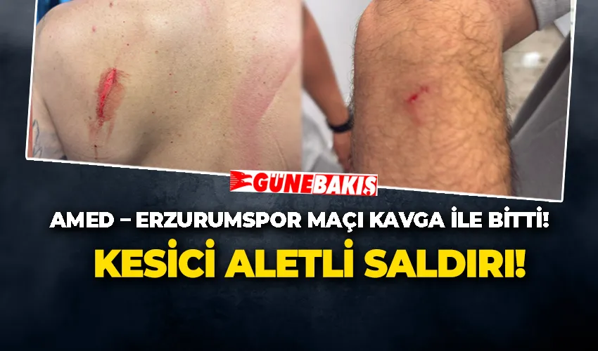 AMED – ERZURUMSPOR MAÇI KAVGA İLE BİTTİ! KESİCİ ALETLİ SALDIRI!