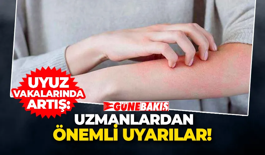 Uyuz Vakalarında Artış: Uzmanlardan Önemli Uyarılar