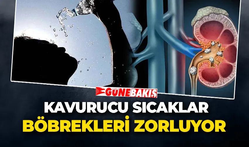 Kavurucu Sıcaklar Böbrekleri Zorluyor